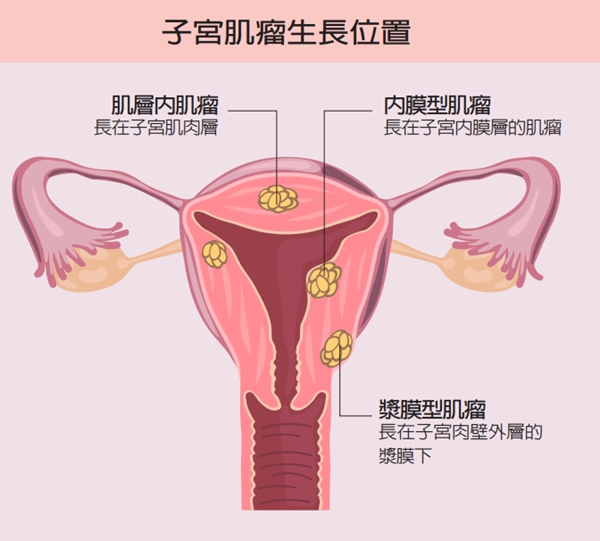photo.jpg