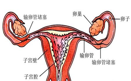 输卵管堵塞是可以做泰国试管婴儿？