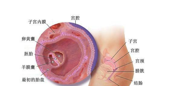试管婴儿移植到什么部位,为什么试管婴儿也会有宫外孕?