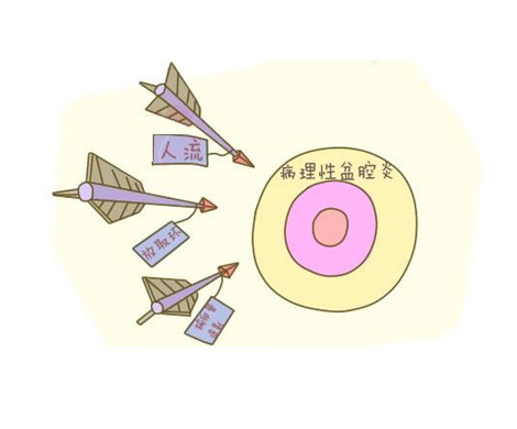 盆腔积液会影响做试管婴儿吗？