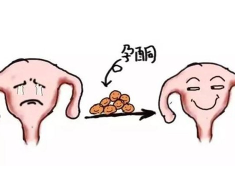 孕酮、HCG与流产在试管婴儿之间的事