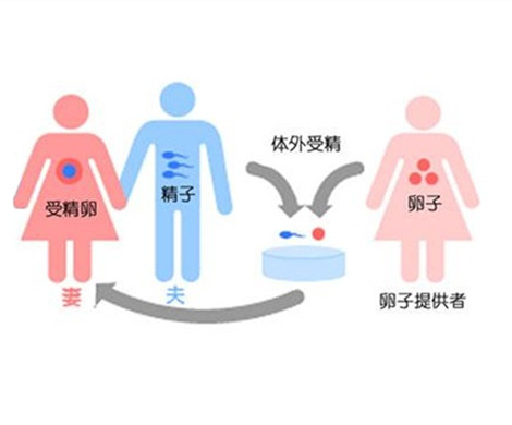 试管婴儿捐卵人与受孕人之间需要血型一样吗？