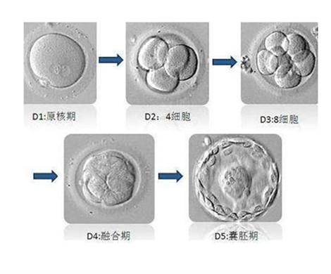 试管婴儿囊胚移植好吗？为什么都选择单囊胚移植?