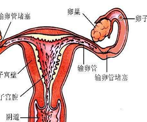 女性输卵管堵塞会出现哪些症状？