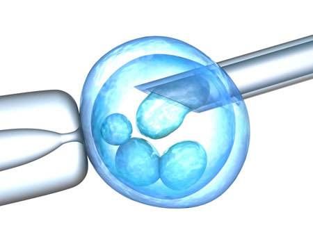 卵浆内单精子注射(ICSI)是如何实现精卵结合的?