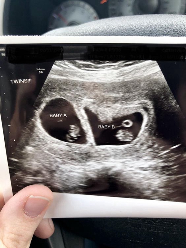 泰国试管婴儿:胚胎停育、流产或是男性精子DNA问题